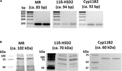 Identification of Mineralocorticoid Receptors, Aldosterone, and Its Processing Enzyme CYP11B2 on Parasympathetic and Sympathetic Neurons in Rat Intracardiac Ganglia